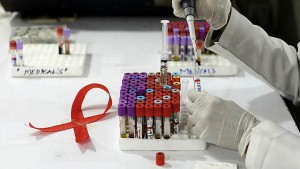 hiv